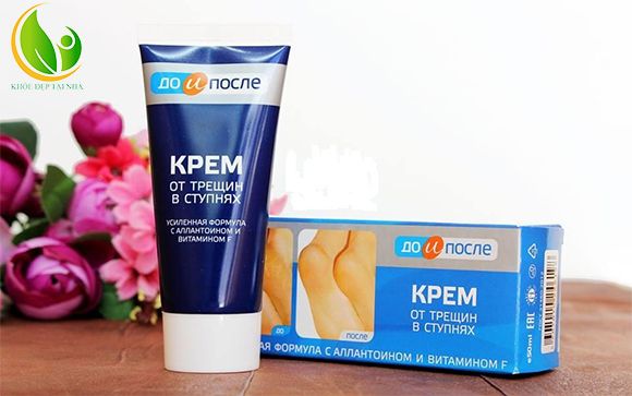 Kem trị nứt gót chân Kpem trong nuôi dưỡng, tái tạo tế bào da.