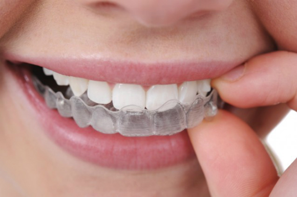 Cơ chế làm trắng răng khoa học của miếng dán trắng răng Crest - khoedeptainha.vn